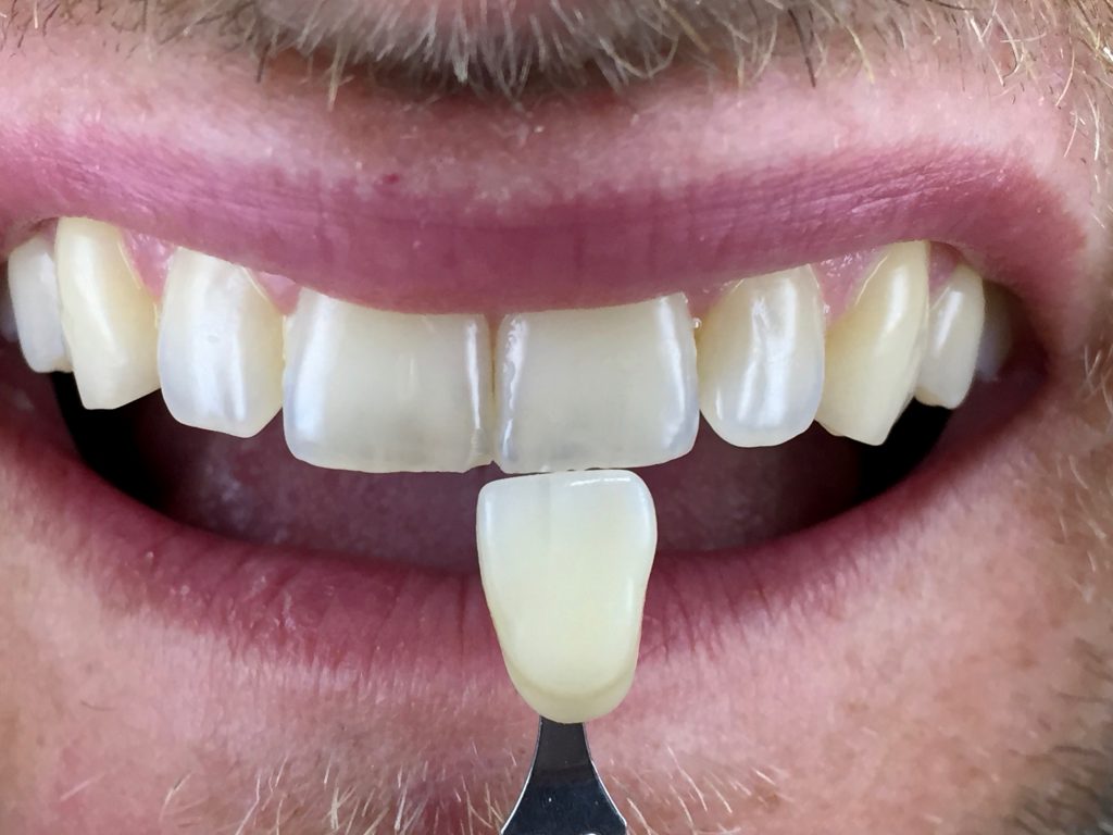 SERVICE DENTALTEAM KEIL